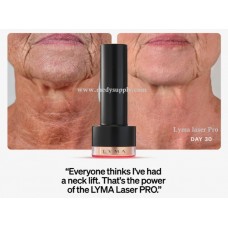Lyma Laser Pro - Sale